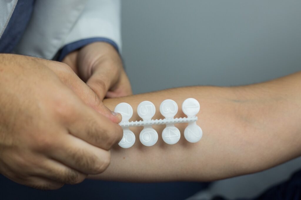 Medical professional performing allergy skin test on patient